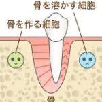 なぜ矯正治療で歯を動かせる？